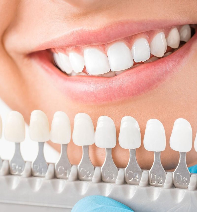 Cosmetic dentistry Cosmetic dentistry