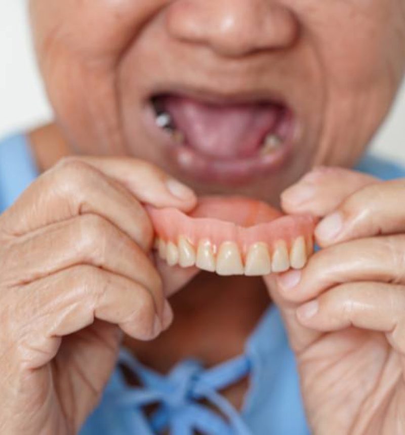 Dentures2 Dentures2