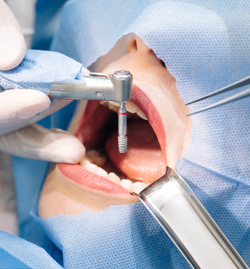 Endodontics Endodontics