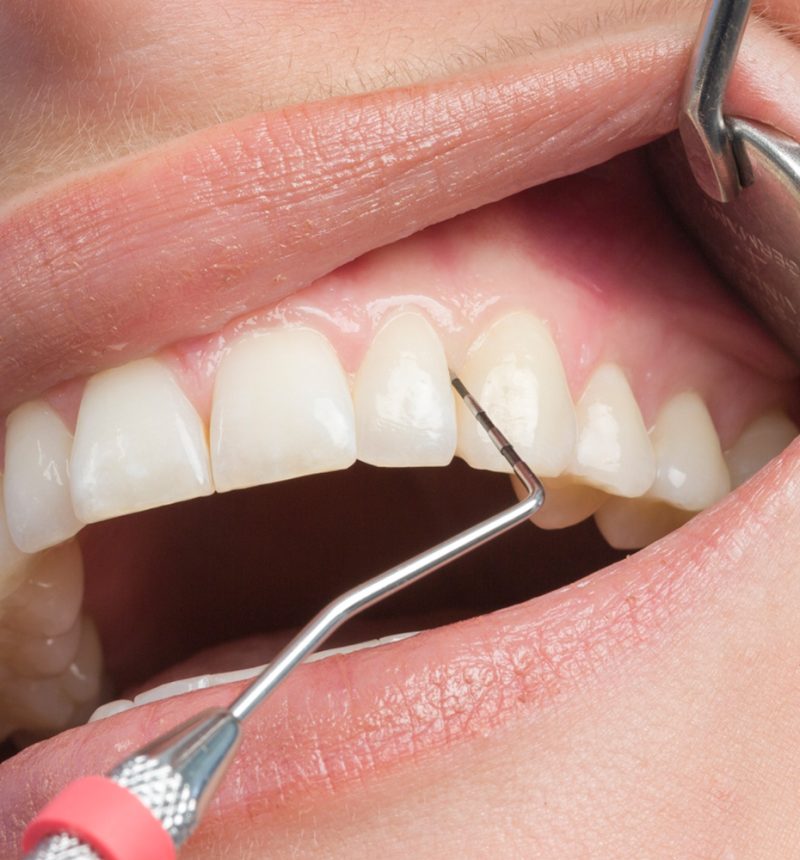 Periodontology2 Periodontology2